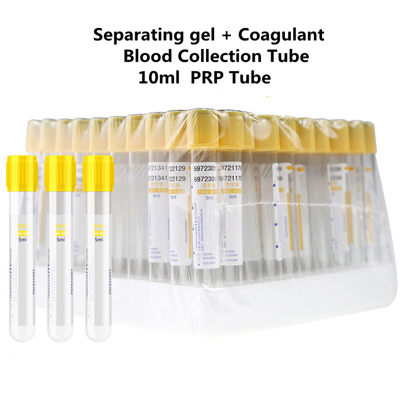 المتاح فراغ جمع الدم أنبوب فصل - مراجعة Medical Lab Blood Test وسعره