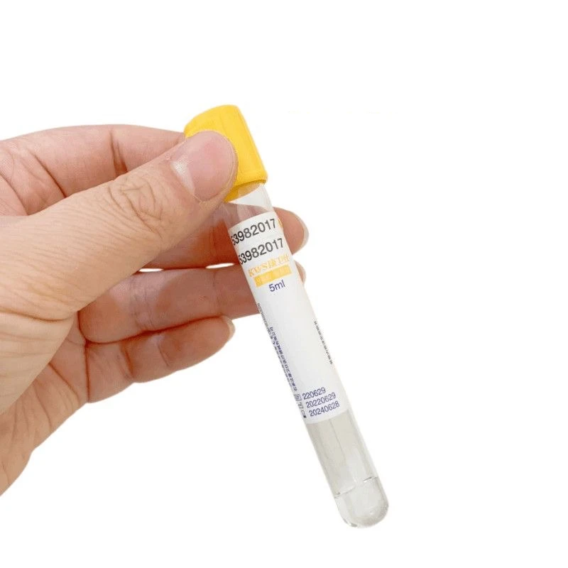 المتاح فراغ جمع الدم أنبوب فصل - مراجعة Medical Lab Blood Test وسعره